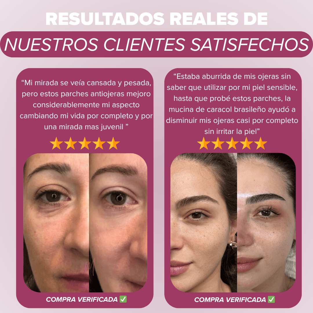 Eliminador anti ojeras mucina caracol brasileña